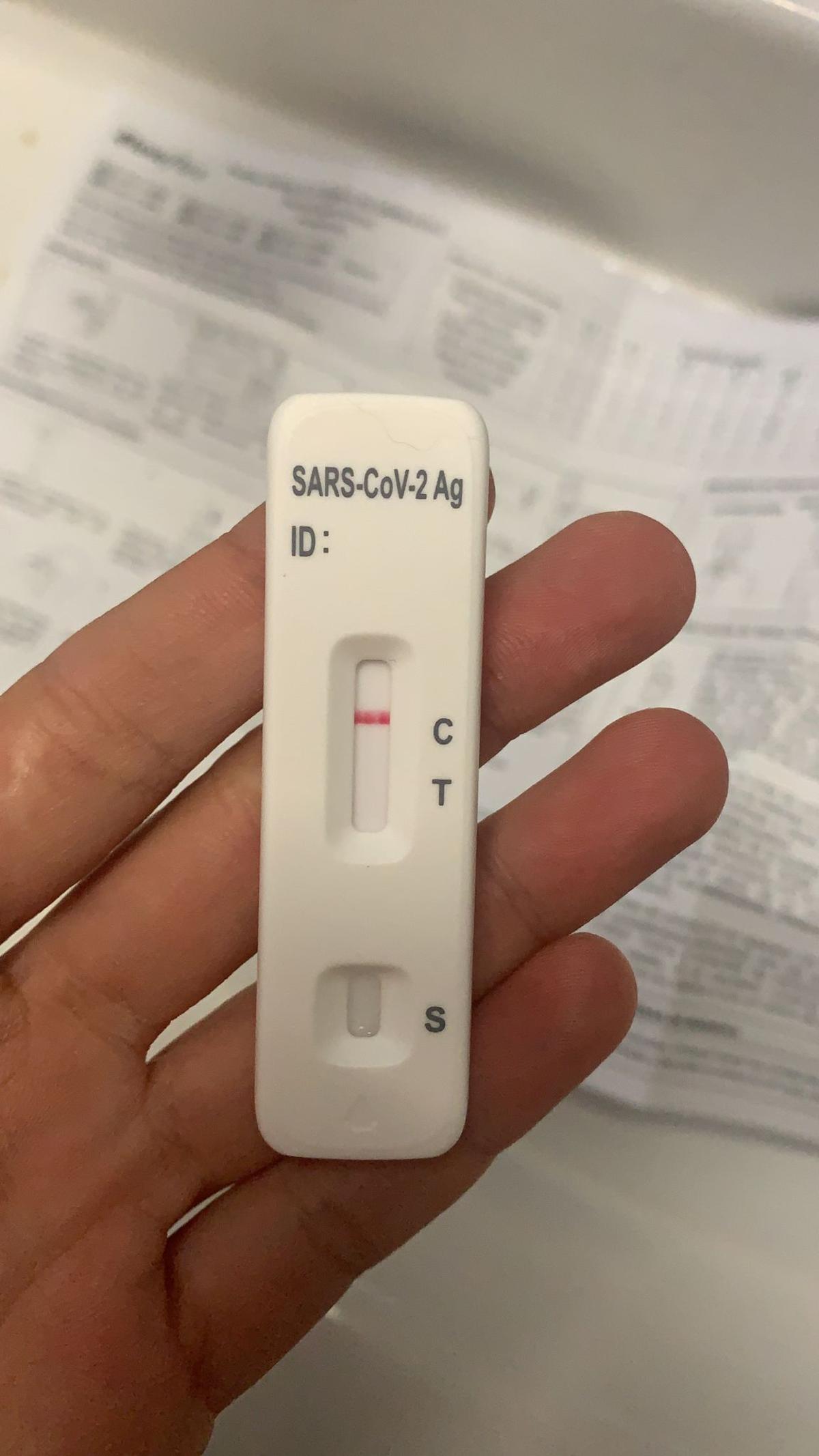 Test de antígenos negativo
