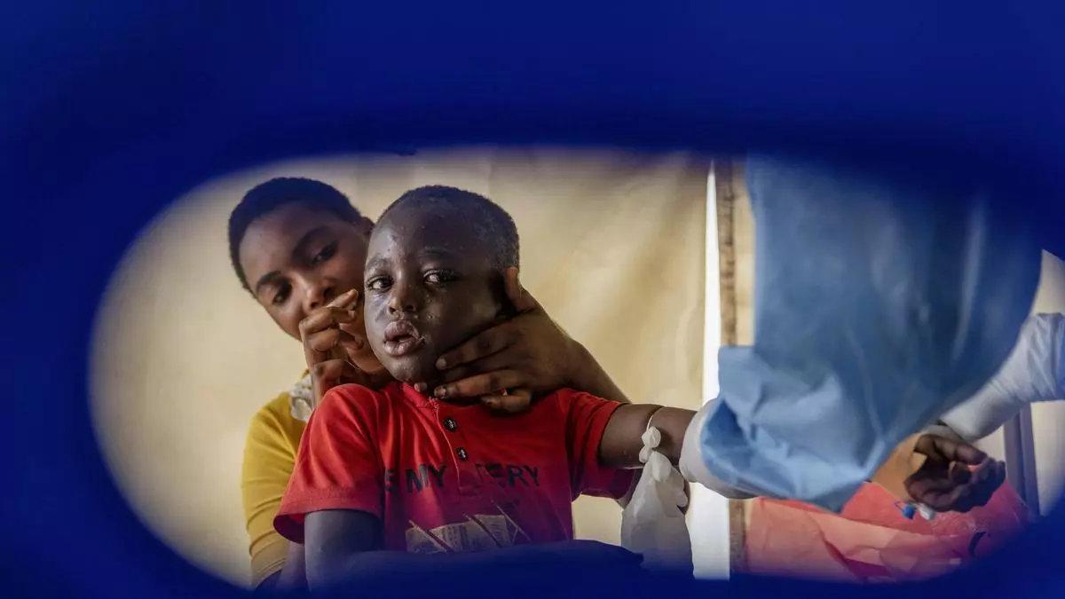 Sanitarios atienden a un niño en la ública Democrática del Congo.