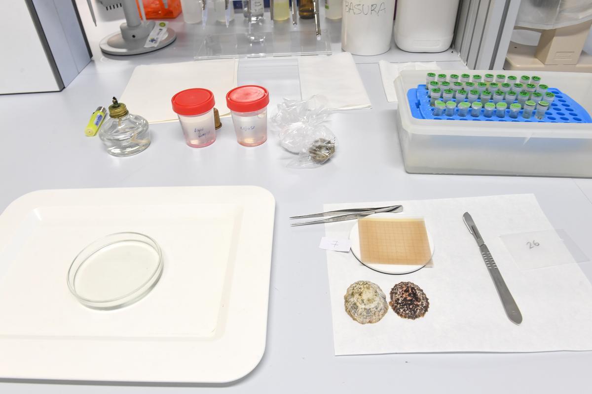 Estudio de las lapas majoreras en los laboratorio de la ULPGC.