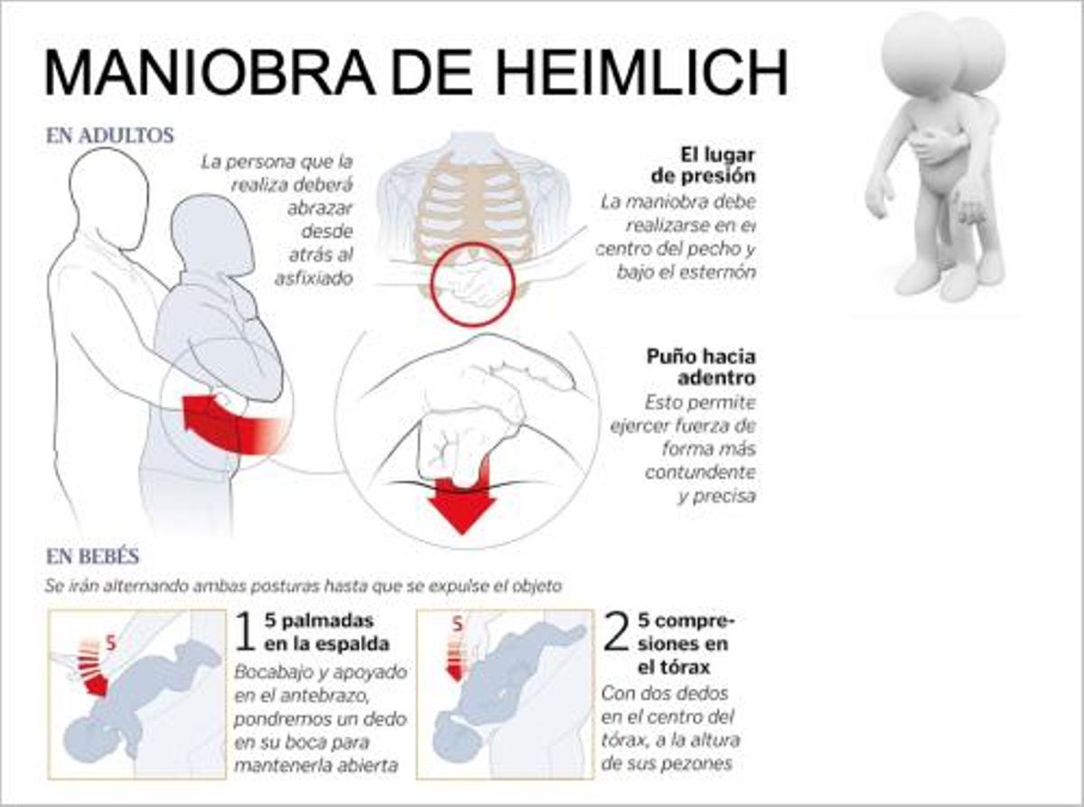 Maniobra heimlich.