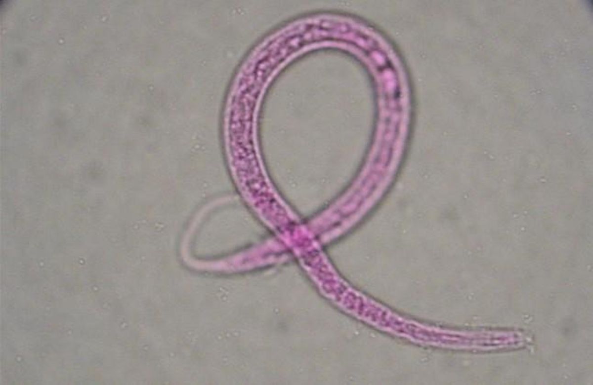Un nematode, un dels constituents més habituals de la meiofauna, observat al microscopi.