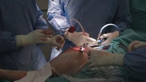 Operación de prótesis de cadera