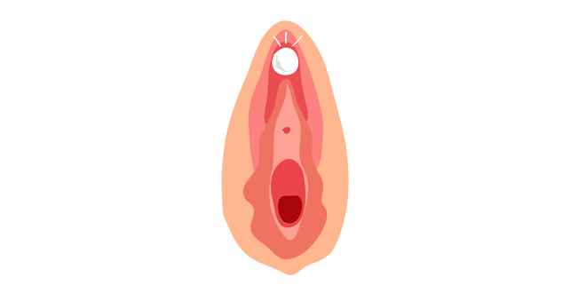 Vulva perla
