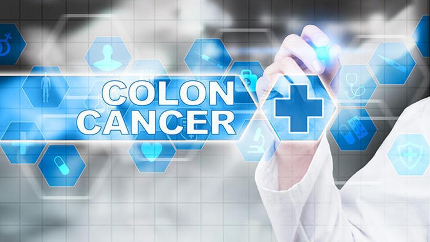 La detección precoz del cáncer de colon es fundamental