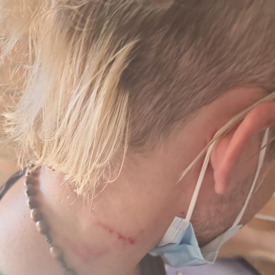 Imagen de las heridas en el cuello recogidas en el parte de la denuncia