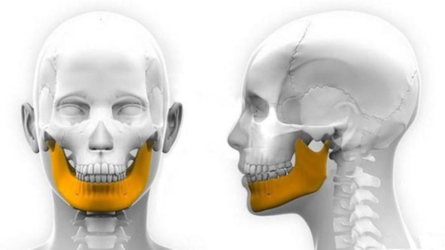 Implantada una mandíbula creada con una impresora 3D de titanio a un niño chino