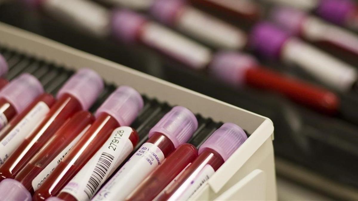zentauroepp9177848 blood samples are pictured at the swiss laboratory for dopin190121180321