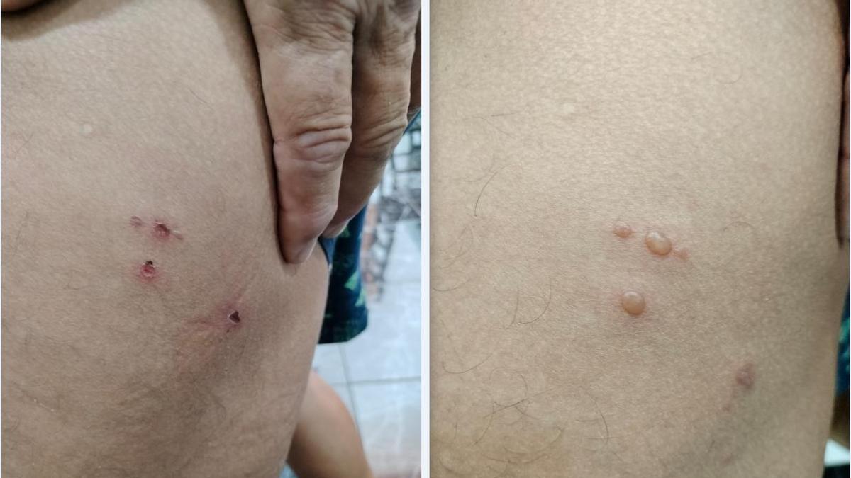 los otros barcos peligrosos que atracan en Canarias sin examen sanitario