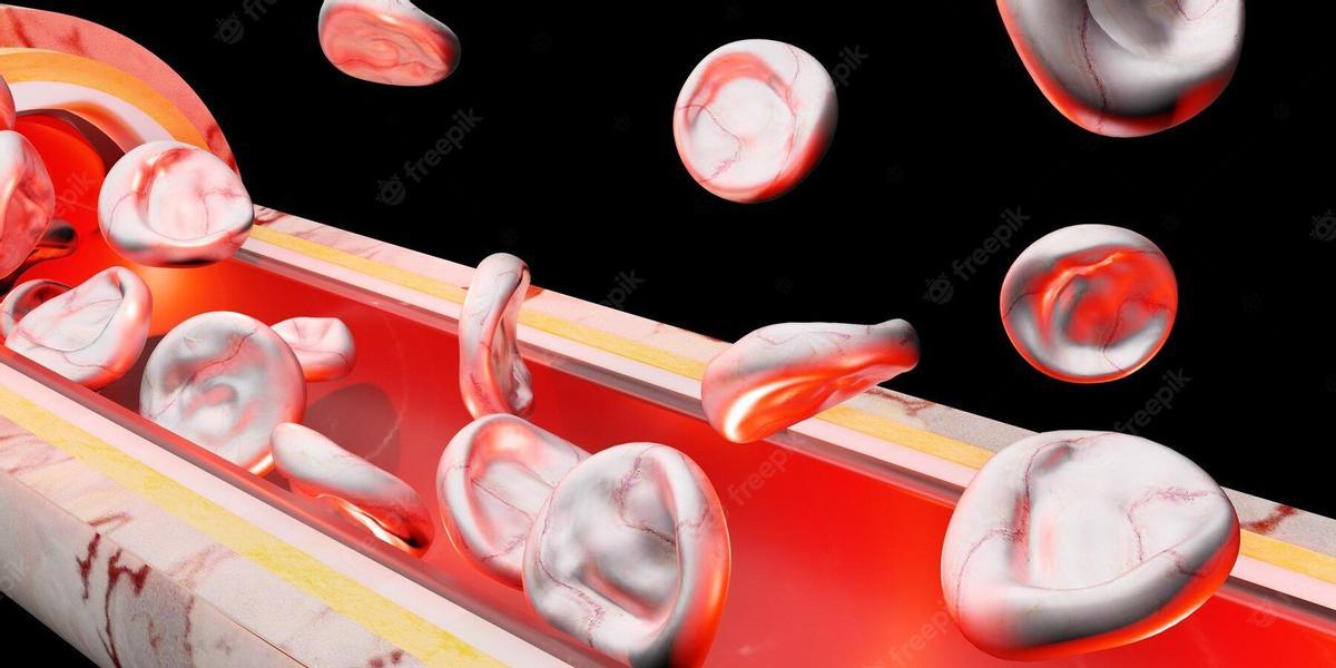 vasculitis 1