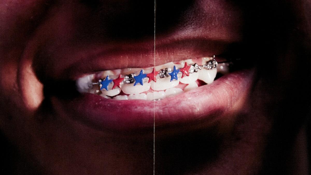 Los brackets del clásico