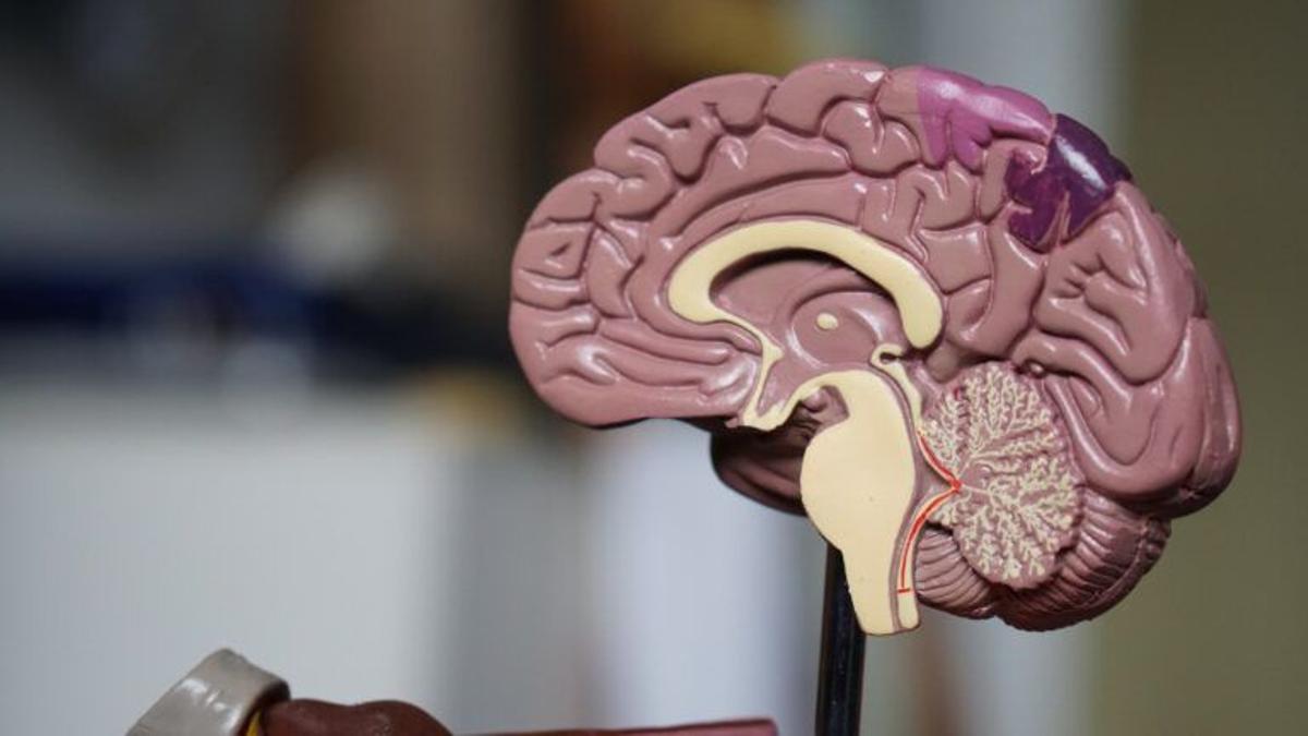 El risc de desenvolupar Alzheimer augmenta entre les persones grans amb covid El risc de desenvolupar Alzheimer augmenta entre les persones grans amb covid