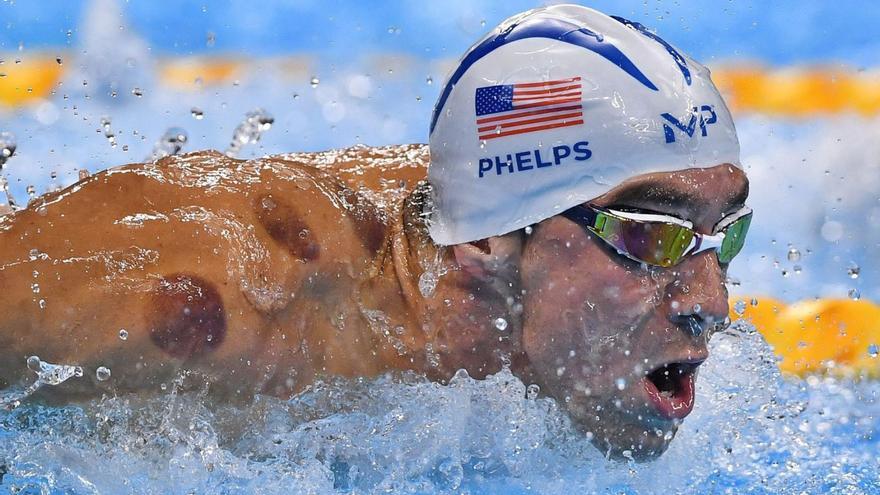 Michael Phelps, con marcas de terapia con ventosas en su hombro en los Juegos de Río 2016.