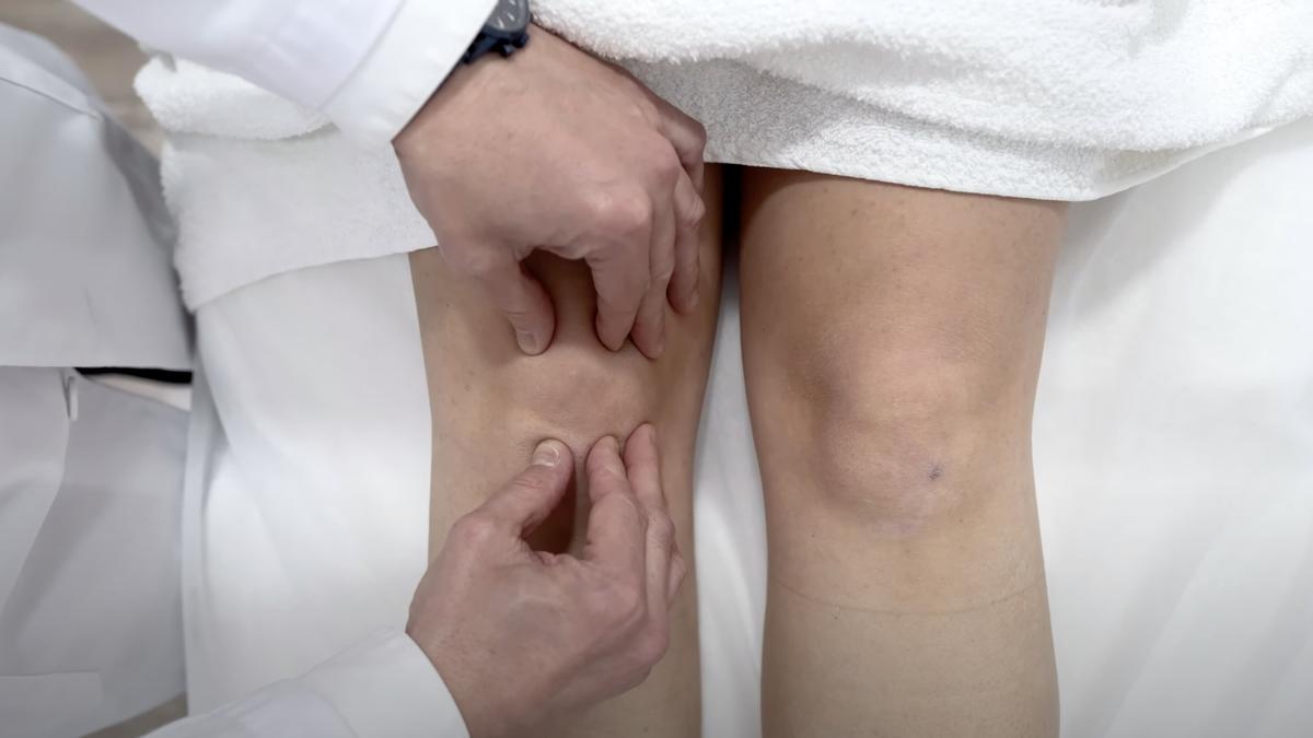 La artrosis rodilla es la de mayor prevalencia en los mayores de 65 años.