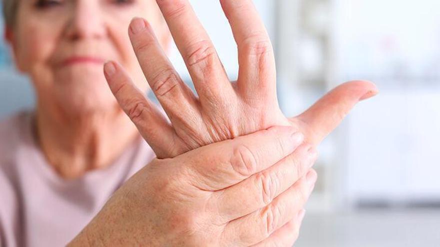 Una dona mostra l’artrosi en una de les seves mans. | DIARI DE GIRONA