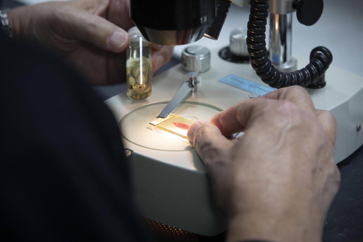 Los gusanos, los parásito de la fascioliasis, son visibles a simple vista.