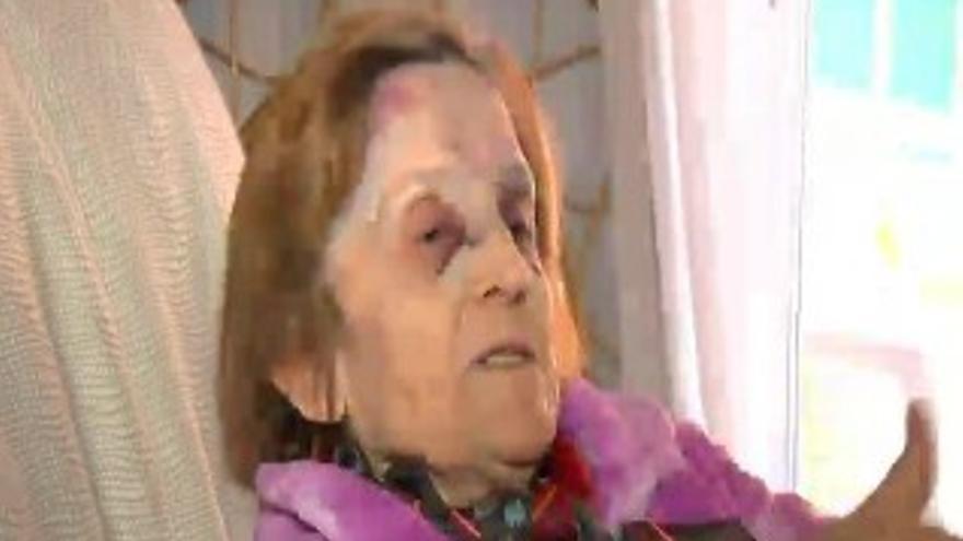 Apalean brutalmente a una anciana en Valencia y le roban 30 euros
