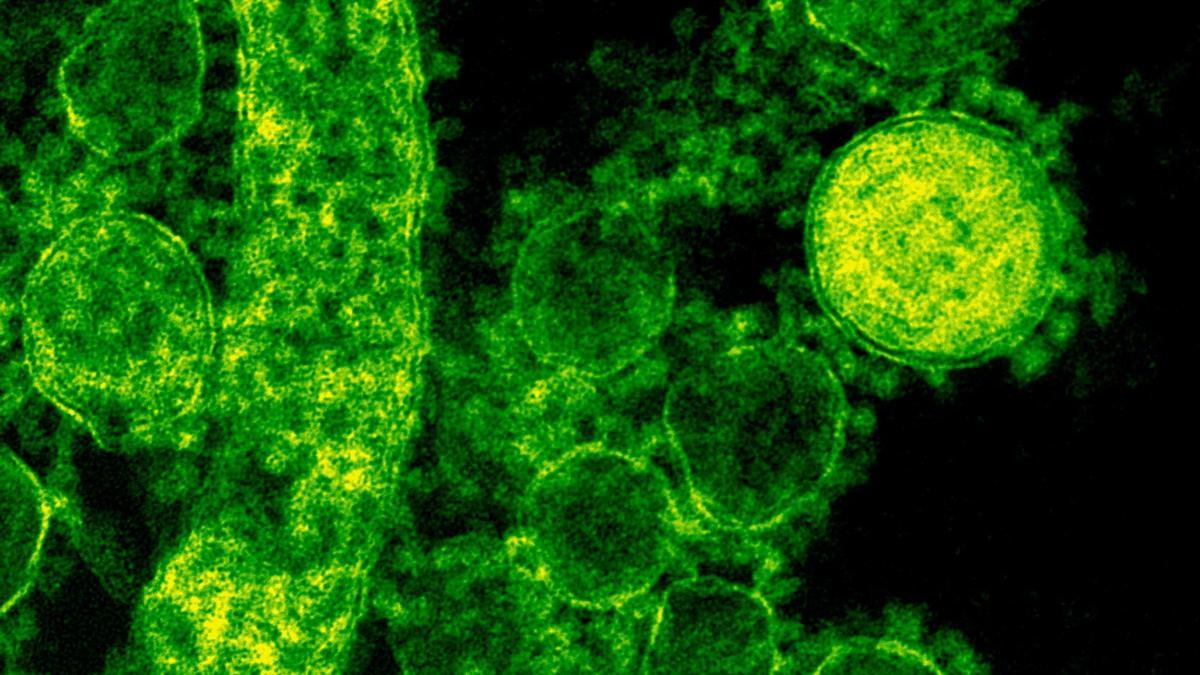 Los virus llevan en la tierra desde mucho antes que los humanos y son muchos más