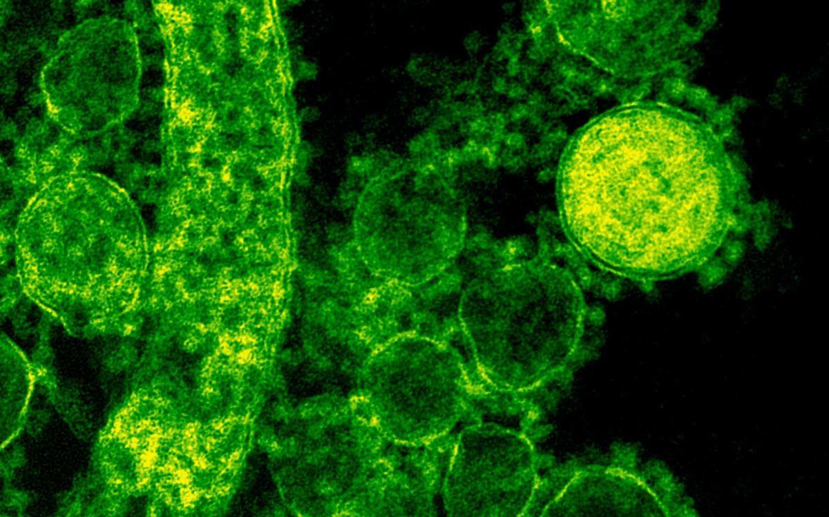 Los virus llevan en la tierra desde mucho antes que los humanos y son muchos más