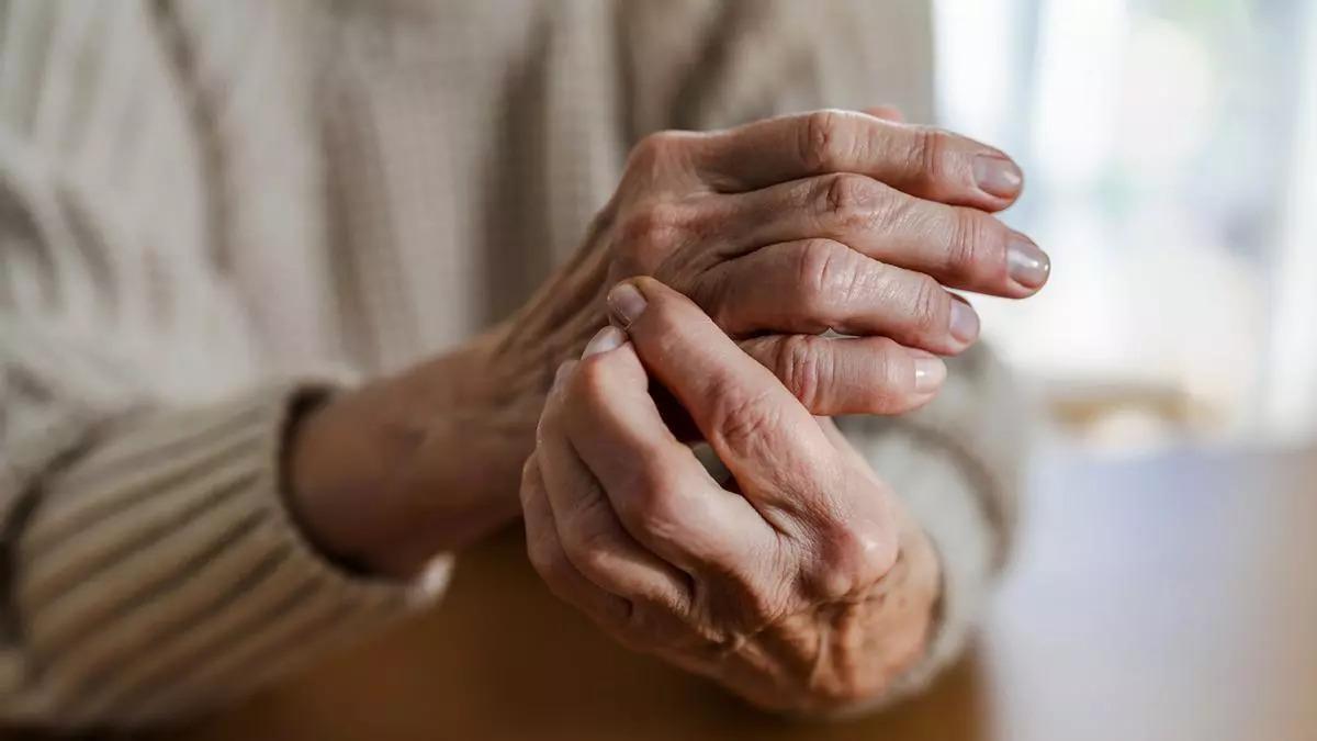 Mans d'una persona amb artritis reumatoide