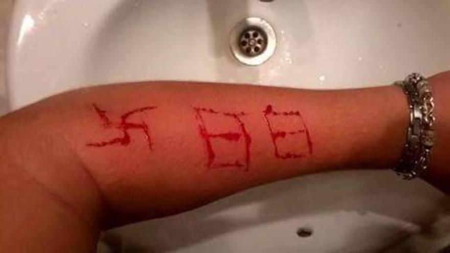 Un grupo de neonazis agrede a un menor marcándole una esvástica en el brazo