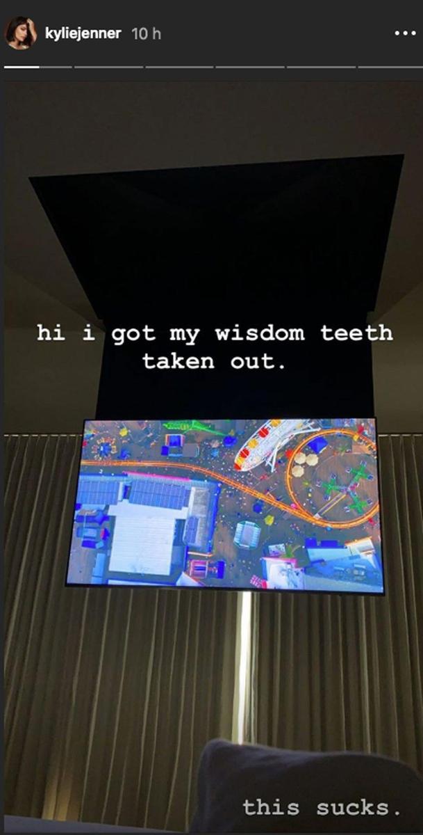 Kylie Jenner le sacan las muelas del juicio.