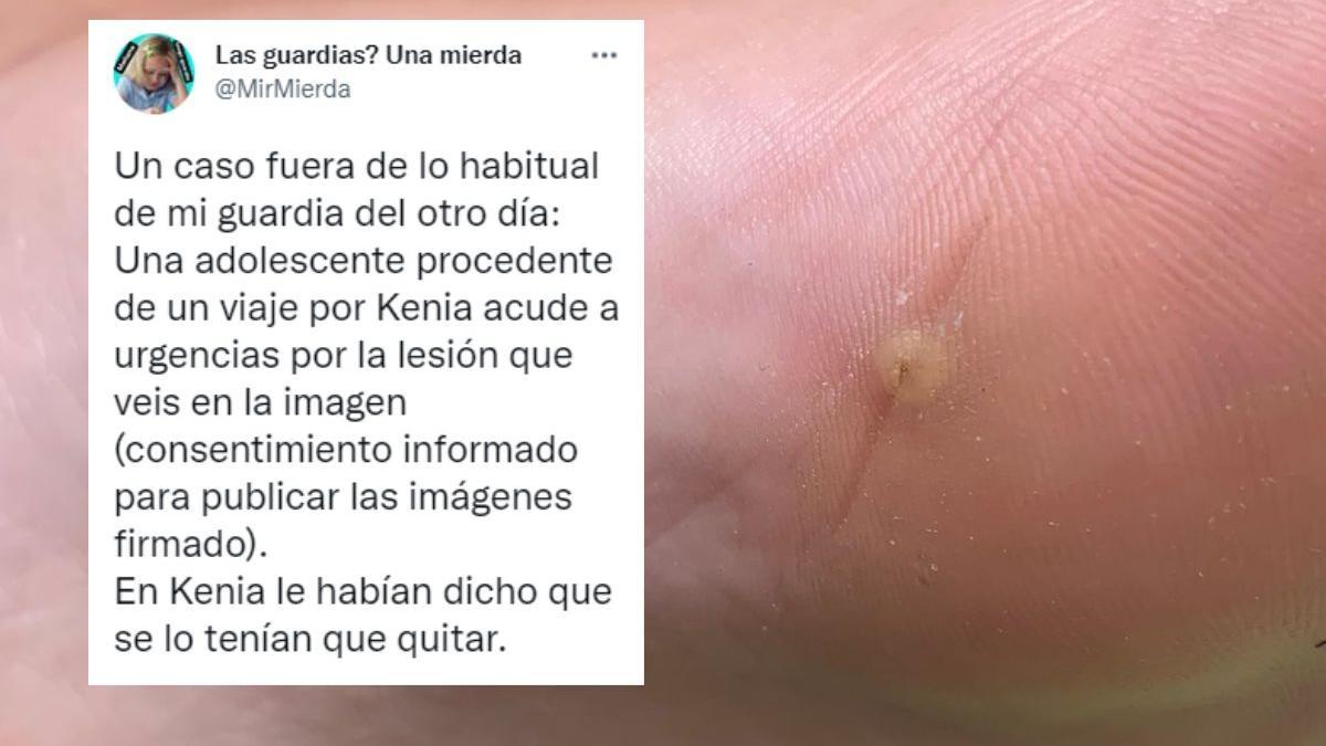 La traumática historia de un médico que te quitará las ganas de andar descalzo por la playa