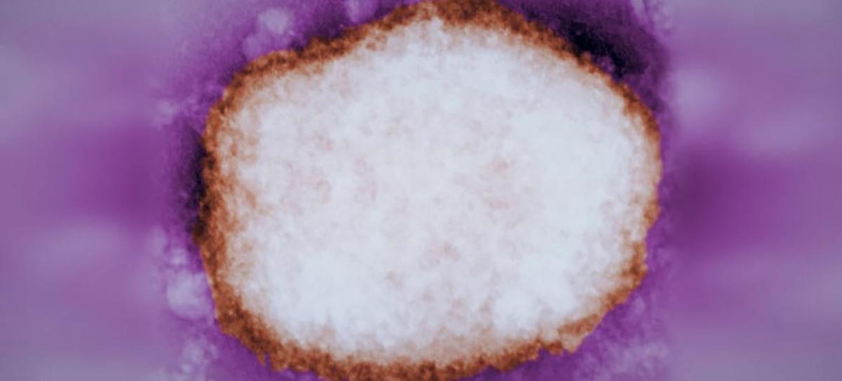 Archivo - Partícula amplificada del virus de la viruela del mono.
