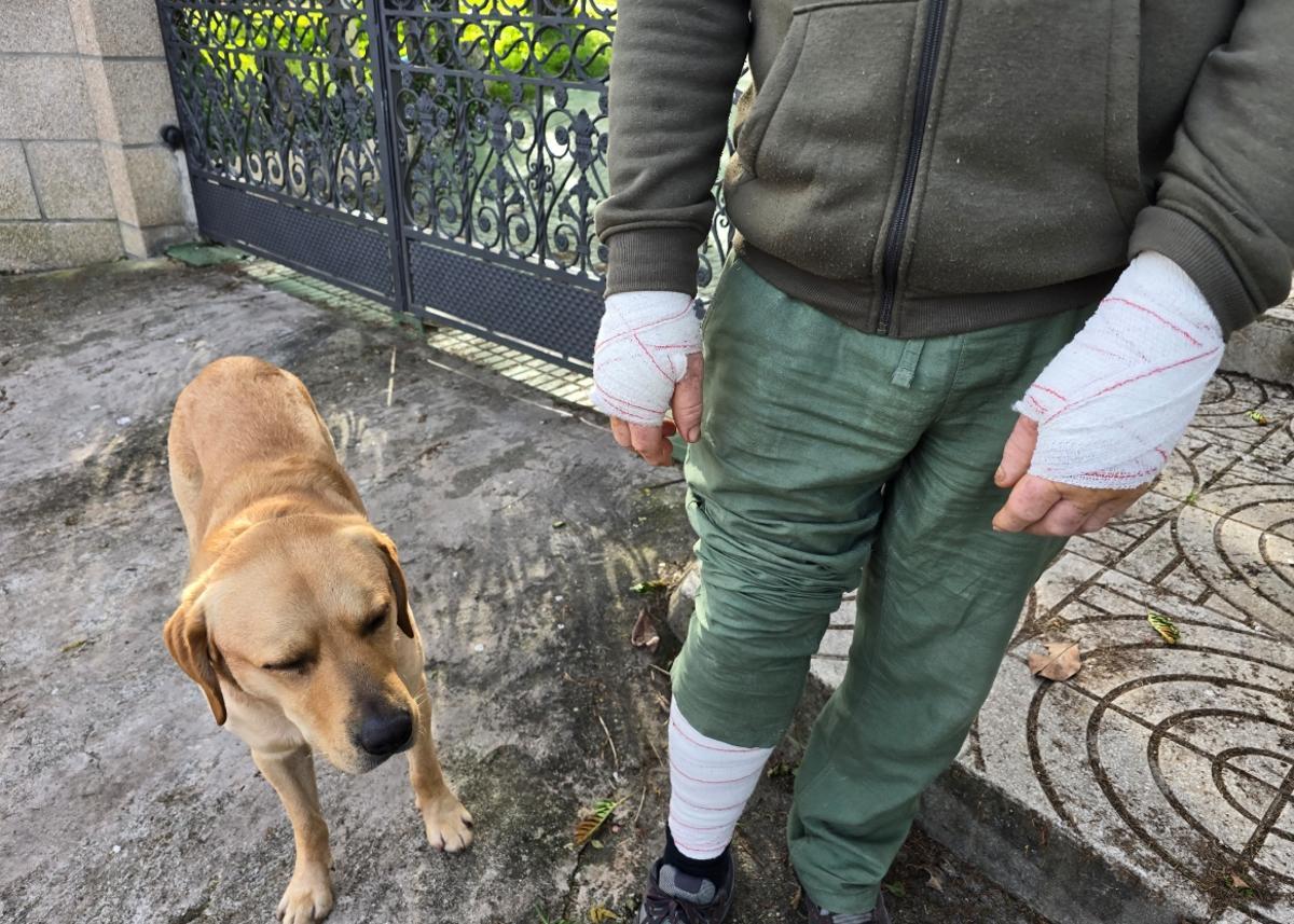 El vecino atacado en brazos y pierna junto a su perro Greco.