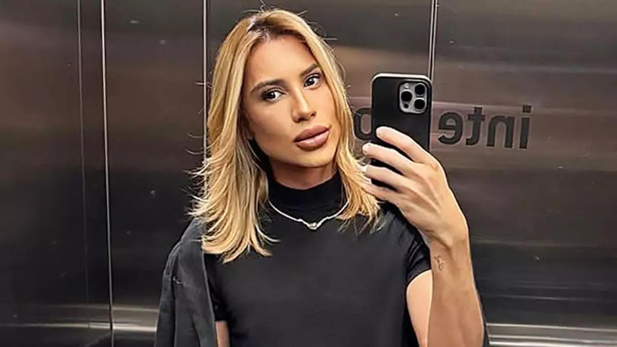Muere a los 31 años la influencer Adair Mendes tras someterse a la cirugía conocida como 'foxy eyes'
