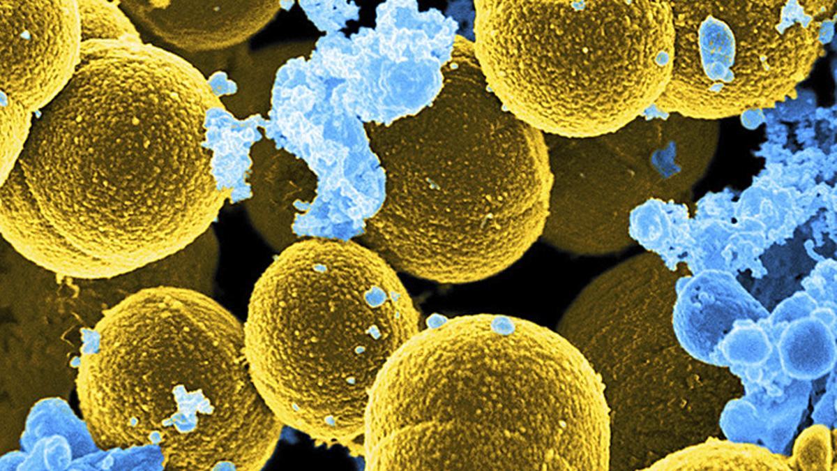 La bacteria staphylococcus aureus, en amarillo, incluida en la lista de la OMS.