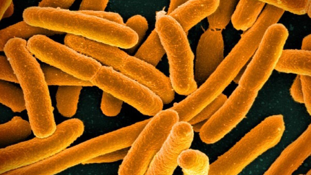 Imagen microscópica de la bacteria E. coli.