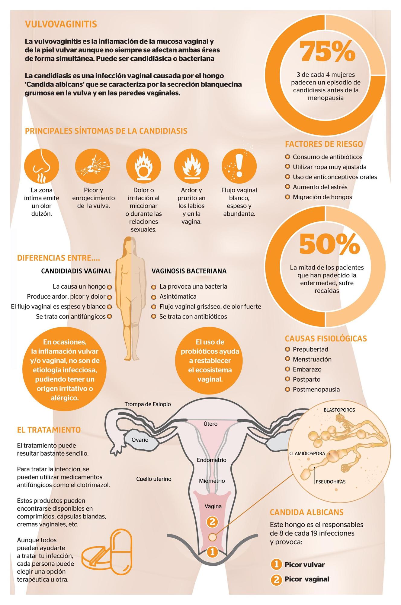 Candidiasis vaginal.