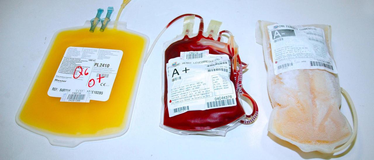 Nach der Blutentnahme wird das Blut in drei Teile geteilt: Blutkörper, Blutplättchen und Plasma.