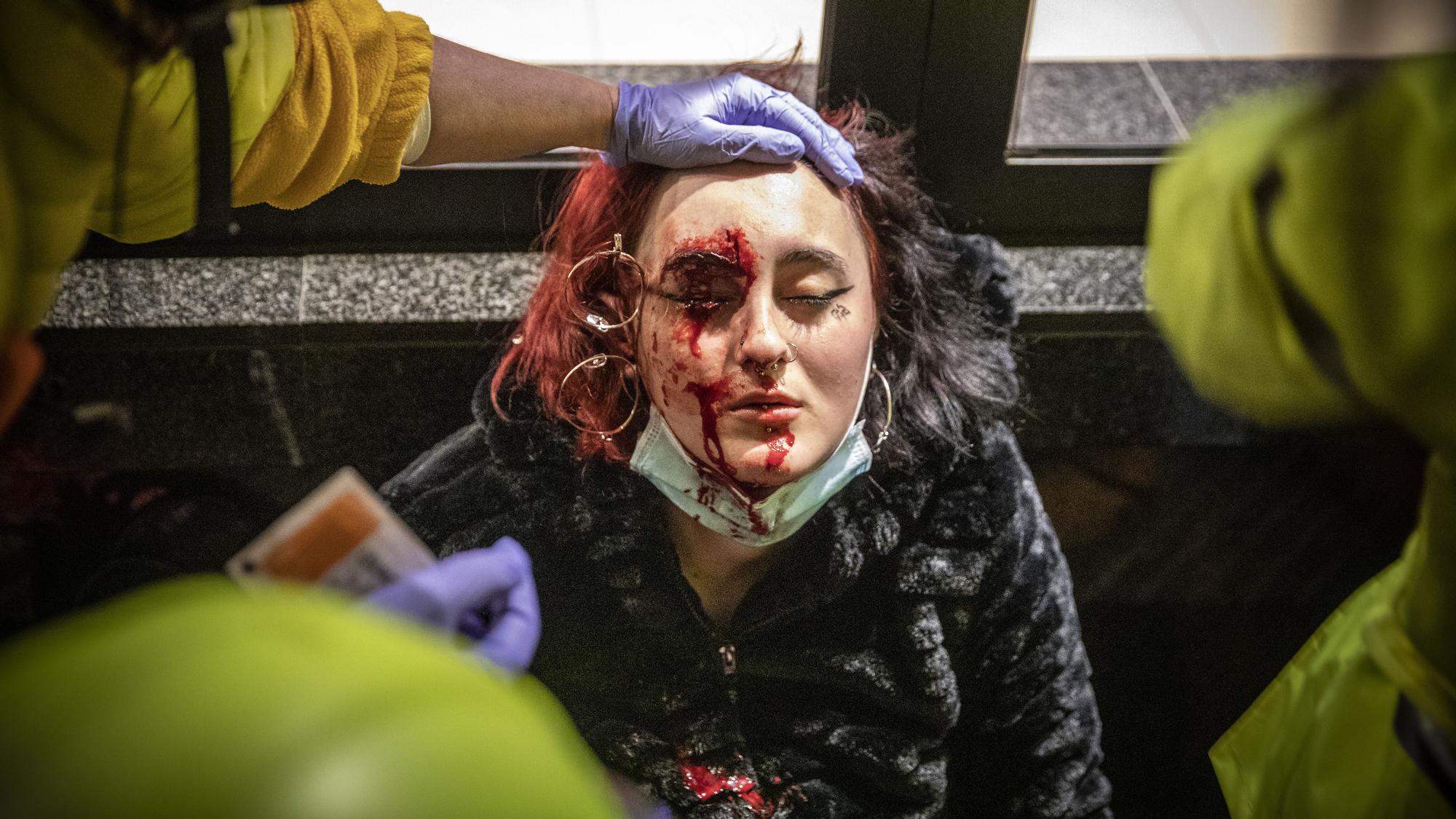 La joven herida por el proyectil de 'foam'.
