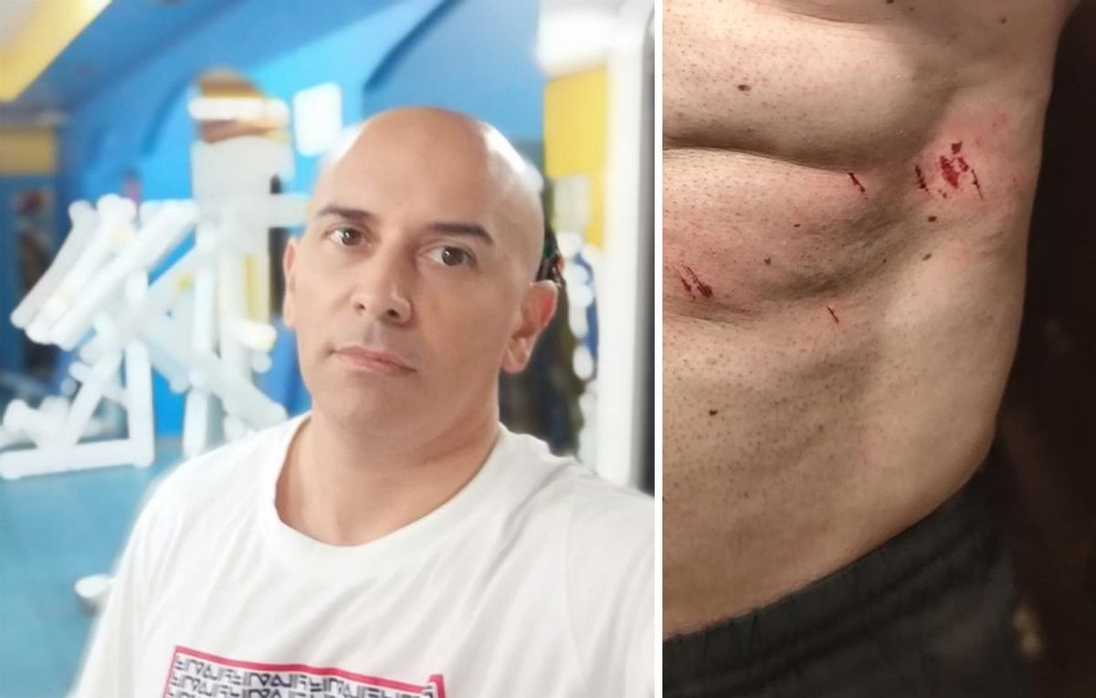 Marcial Rial y algunas de las heridas que sufrió ayer