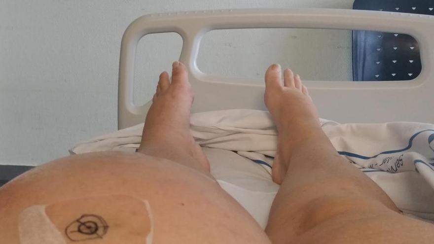 Reabren el caso de una mujer que perdió una pierna por fallo médico