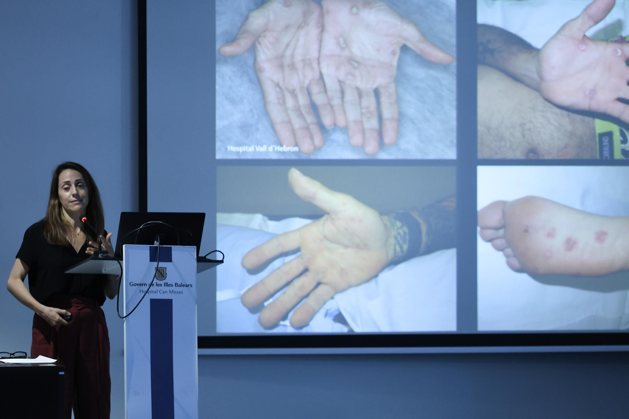 Galería: Jornada sobre enfermedades de transmisión sexual en Can Misses
