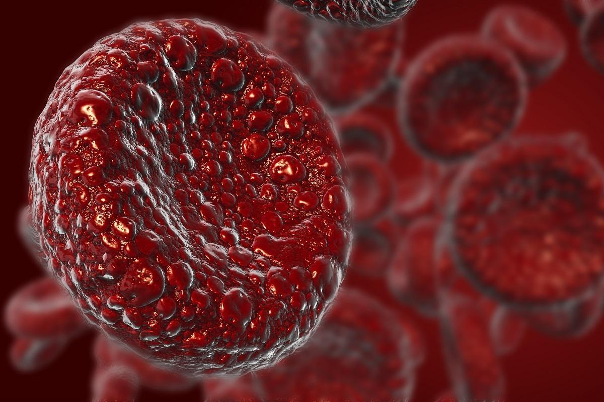 Este alimento puede ayudar a elevar los niveles de hierro en sangre.