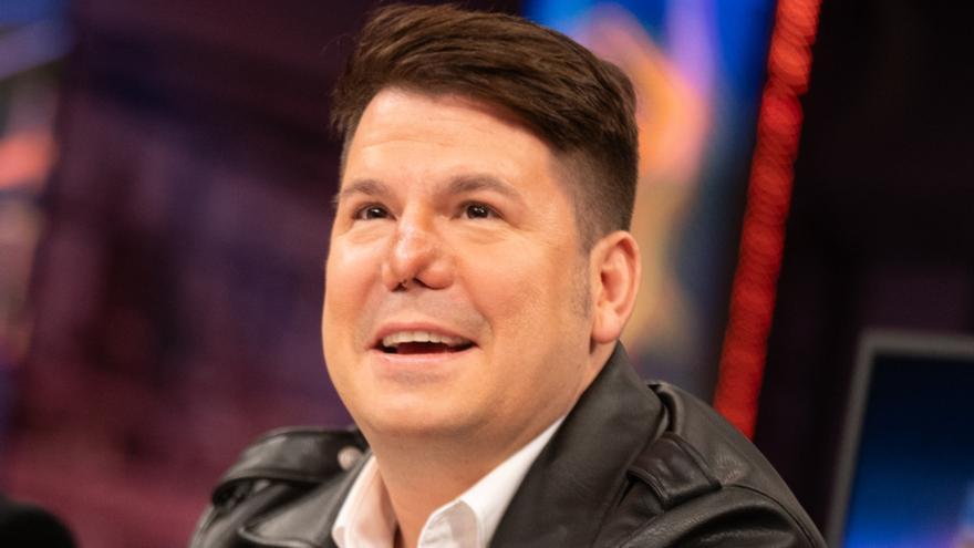 Rinoplastia fallida de Lucas (Andy y Lucas): cirujano plástico dice que el resultado es poco común