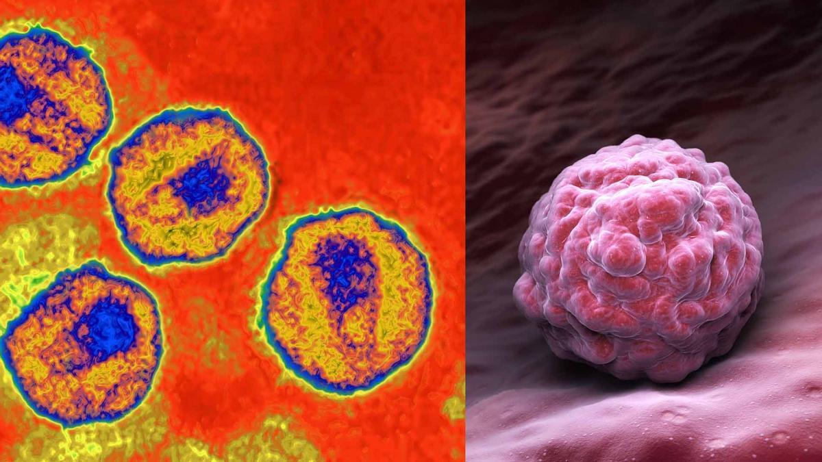 Se confirma el tercer caso de VIH curado gracias a un transplante de células madre