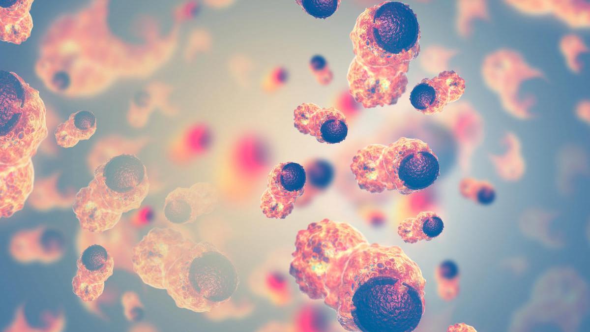 An image of cancer cells. An image of cancer cells.