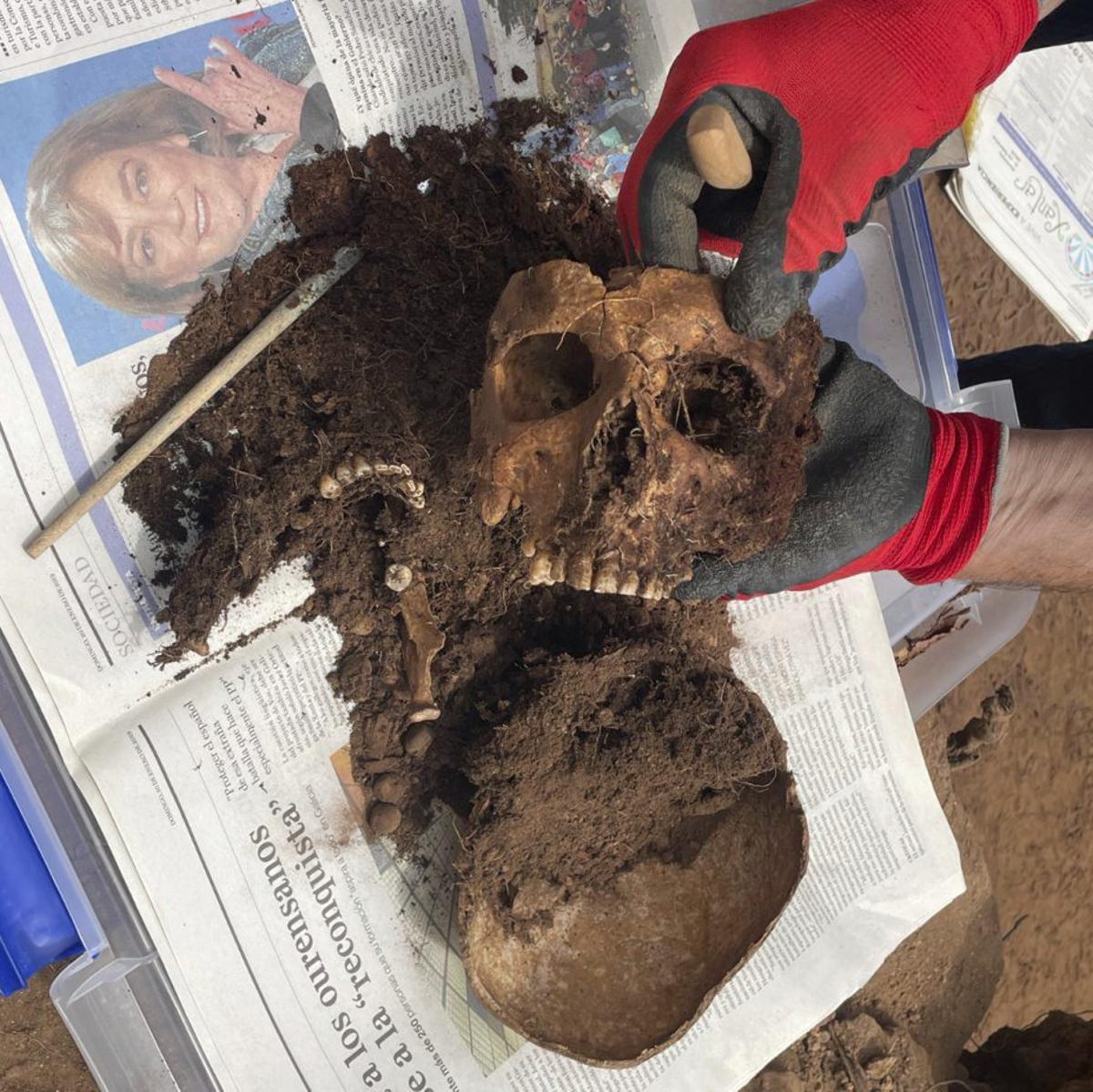 Calavera del cuerpo encontrado en la excavación de Chan da Ponte. | D.P.