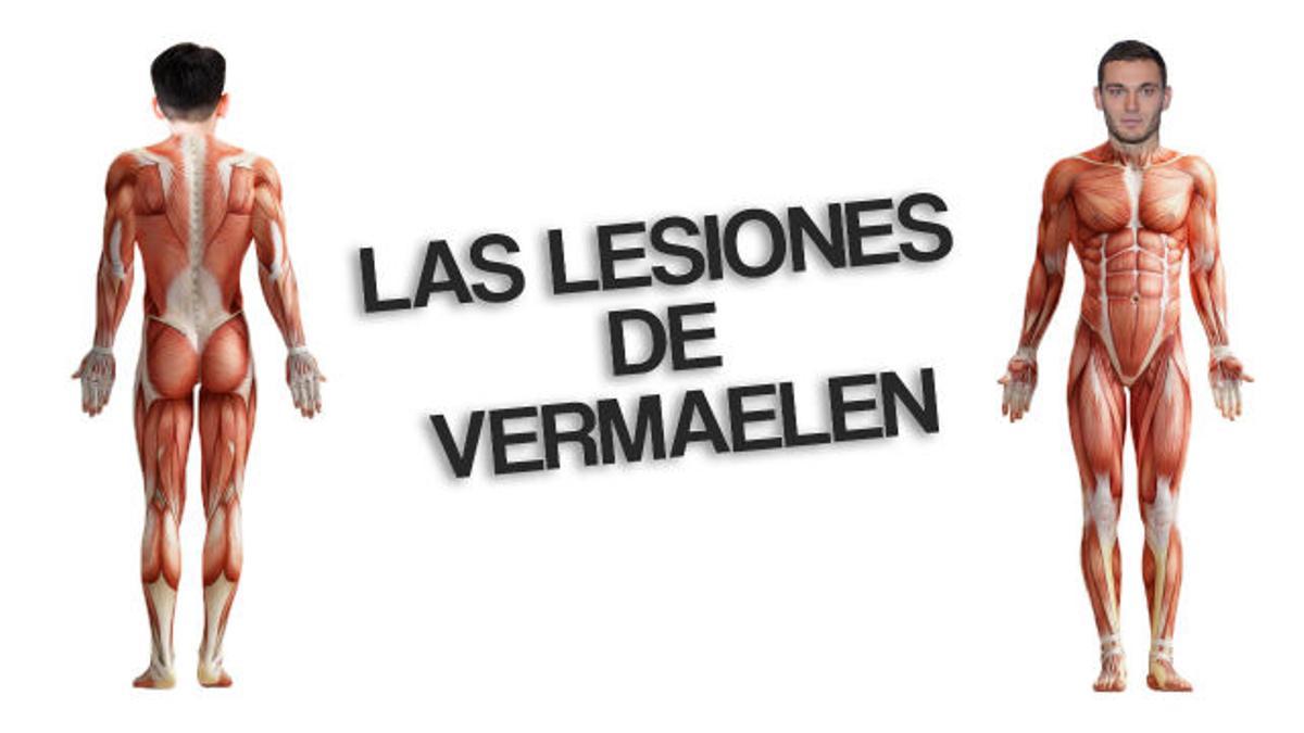 Todas las lesiones que ha sufrido Vermaelen