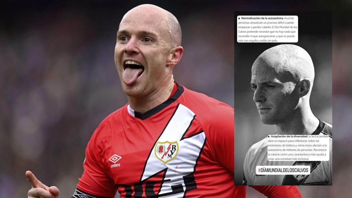 Isi Palazón se reivindica a favor de la calvície