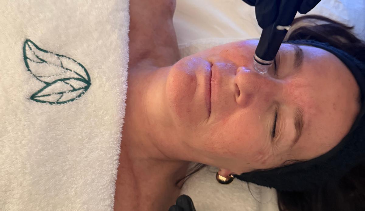 El protocolo que está redefiniendo el rejuvenecimiento facial