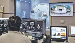 Sanitat deixa sense servici de ressonància magnètica l’Hospital Vega Baja d’Orihuela de vesprada, segons denuncia UGT