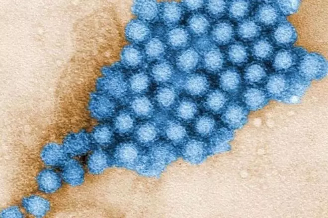 Qué es el contagioso norovirus que ha provocado un brote de 144 casos en Almería