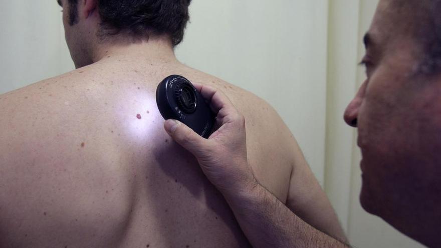 El móvil podría detectar el cáncer de piel