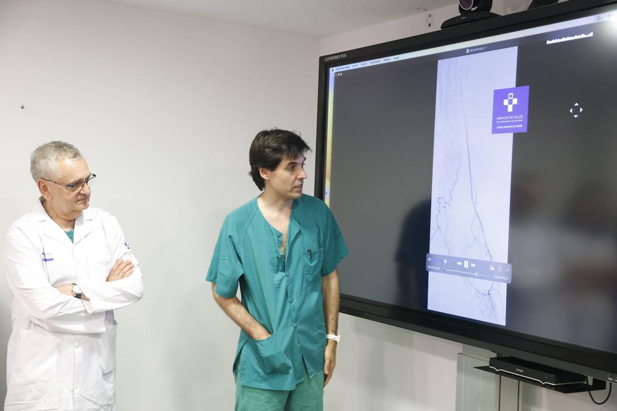 El servicio de Angiología y Cirugía Vascular ya ha realizado dos intervenciones con este procedimiento.