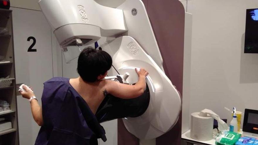 Mamografies amb menys dolor, radiació i estrès